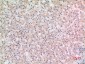Cryopyrin Polyclonal Antibody